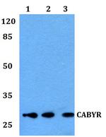 CABYR Polyclonal Antibody