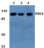 Desmoglein 4 Antibody in Western Blot (WB)