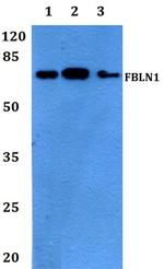 Fibulin 1 Polyclonal Antibody