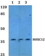 HOXC12 Polyclonal Antibody