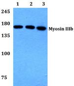 MYO3B Polyclonal Antibody
