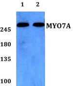 MYO7A Polyclonal Antibody