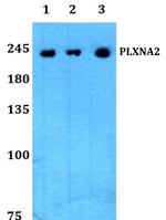 Plexin A2 Polyclonal Antibody