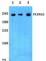 Plexin A2 Antibody in Western Blot (WB)