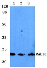 RAB30 Polyclonal Antibody