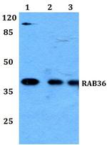RAB36 Antibody in Western Blot (WB)