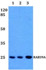 RAB39A Polyclonal Antibody