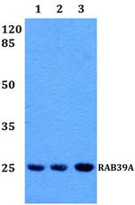 RAB39A Antibody in Western Blot (WB)