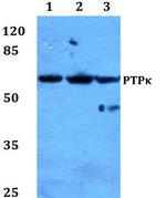 PTPRK Polyclonal Antibody