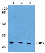 SHOX Polyclonal Antibody