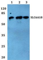 SLC6A18 Antibody in Western Blot (WB)