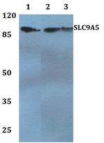 SLC9A5 Polyclonal Antibody