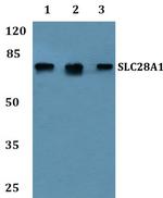 SLC28A1 Polyclonal Antibody