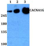 CaV3.1 Polyclonal Antibody