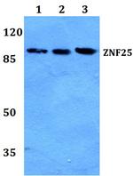 ZNF25 Polyclonal Antibody