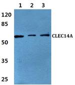 CLEC14A Antibody in Western Blot (WB)