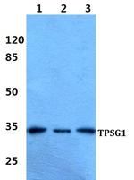 TPSG1 Antibody in Western Blot (WB)
