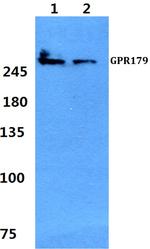 GPR179 Polyclonal Antibody