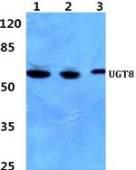 UGT8 Polyclonal Antibody
