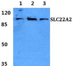 SLC22A2 Polyclonal Antibody