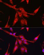 GSS Antibody in Immunocytochemistry (ICC/IF)