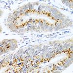 FAM3B Antibody in Immunohistochemistry (Paraffin) (IHC (P))