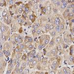 GAS2 Polyclonal Antibody