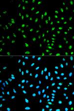NCF2 Polyclonal Antibody