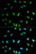 SELENBP1 Polyclonal Antibody