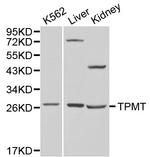 TPMT Polyclonal Antibody