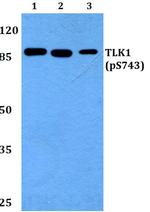Phospho-TLK1 (Ser743) Polyclonal Antibody