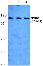Phospho-EphB3 (Tyr608) Polyclonal Antibody