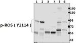 Phospho-ROS1 (Tyr2114) Polyclonal Antibody