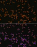 CHI3L1 Polyclonal Antibody