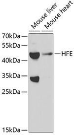 HFE Polyclonal Antibody