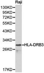 HLA-DRB3 Antibody in Western Blot (WB)
