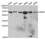 HMBS Polyclonal Antibody