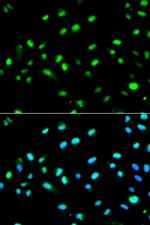 LETMD1 Polyclonal Antibody