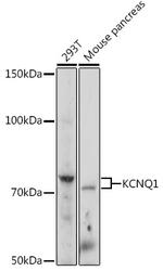 KCNQ1 Polyclonal Antibody