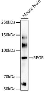 RPGR Polyclonal Antibody