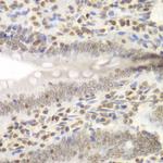 UHRF2 Antibody in Immunohistochemistry (Paraffin) (IHC (P))