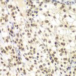 UHRF2 Antibody in Immunohistochemistry (Paraffin) (IHC (P))