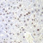 UHRF2 Antibody in Immunohistochemistry (Paraffin) (IHC (P))