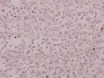 CRSP130 Polyclonal Antibody