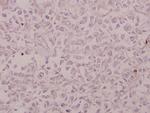 CRSP130 Antibody in Immunohistochemistry (Paraffin) (IHC (P))