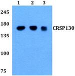 CRSP130 Antibody in Western Blot (WB)