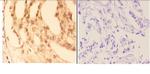 COL19A1 Antibody in Immunohistochemistry (Paraffin) (IHC (P))