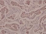 COL19A1 Antibody in Immunohistochemistry (Paraffin) (IHC (P))