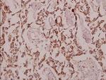 GCP3 Polyclonal Antibody