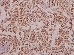 Kir2.1 (KCNJ2) Antibody in Immunohistochemistry (Paraffin) (IHC (P))